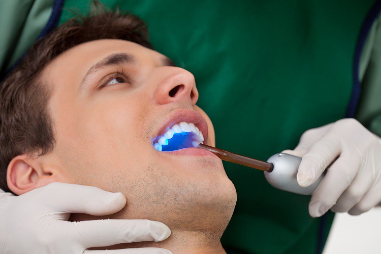 Xwusaf80cvr5zqyjb2k3 Dental Bonding Procedure