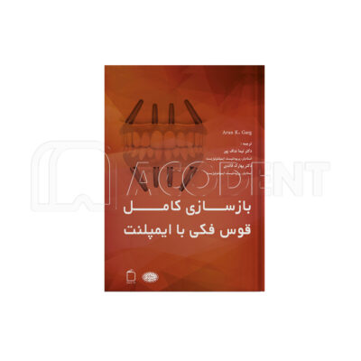 بازسازی کامل قوس فکی با ایمپلنت