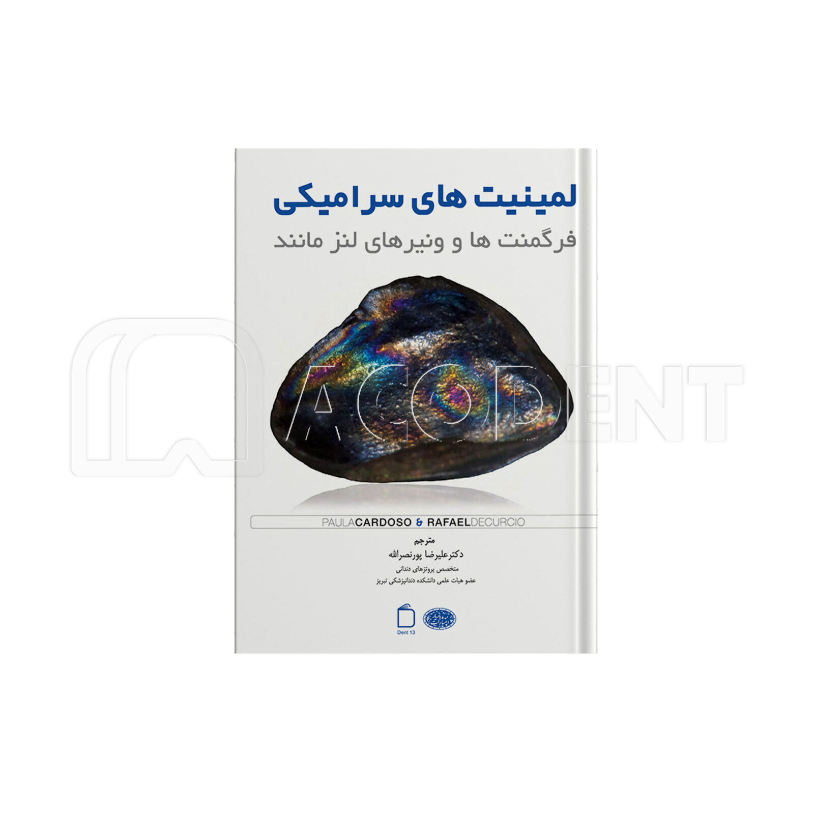 لمینیت های سرامیکی – فرگمنت ها و ونیرهای لنز مانند