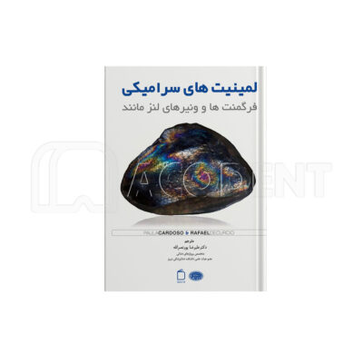 لمینیت های سرامیکی – فرگمنت ها و ونیرهای لنز مانند