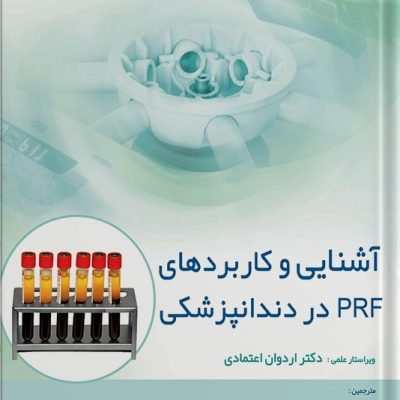 آشنایی و کاربردهای Prf در دندانپزشکی