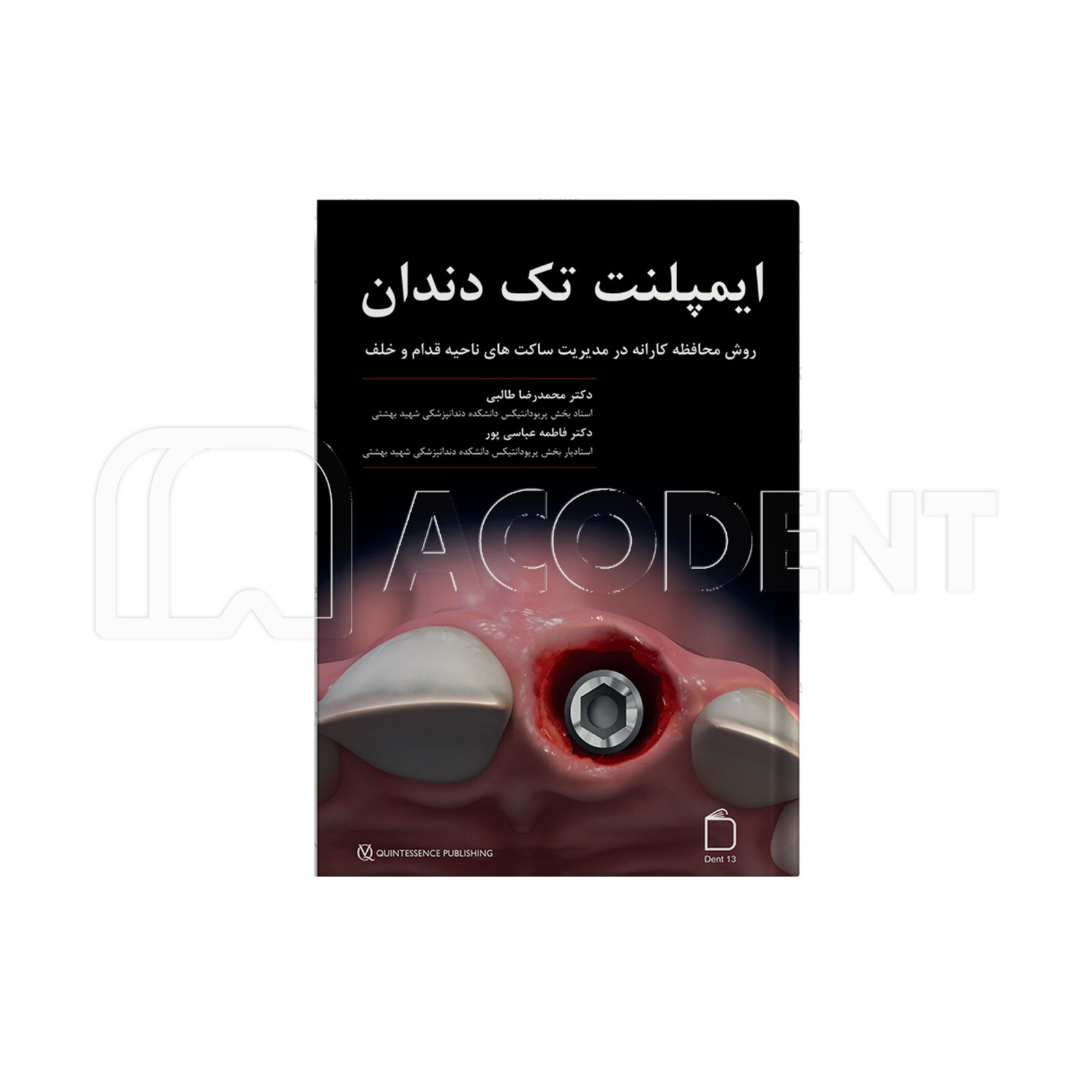 ایمپلنت تک دندان