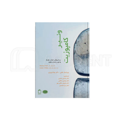 ونیر کامپوزیت به روش مستقیم و غیر مستقیم