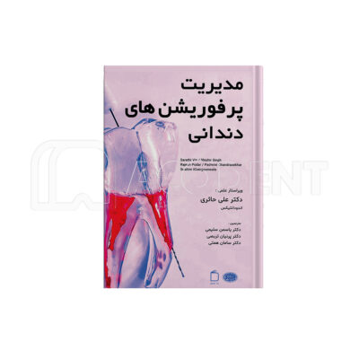 مدیریت پرفوریشن های دندانی