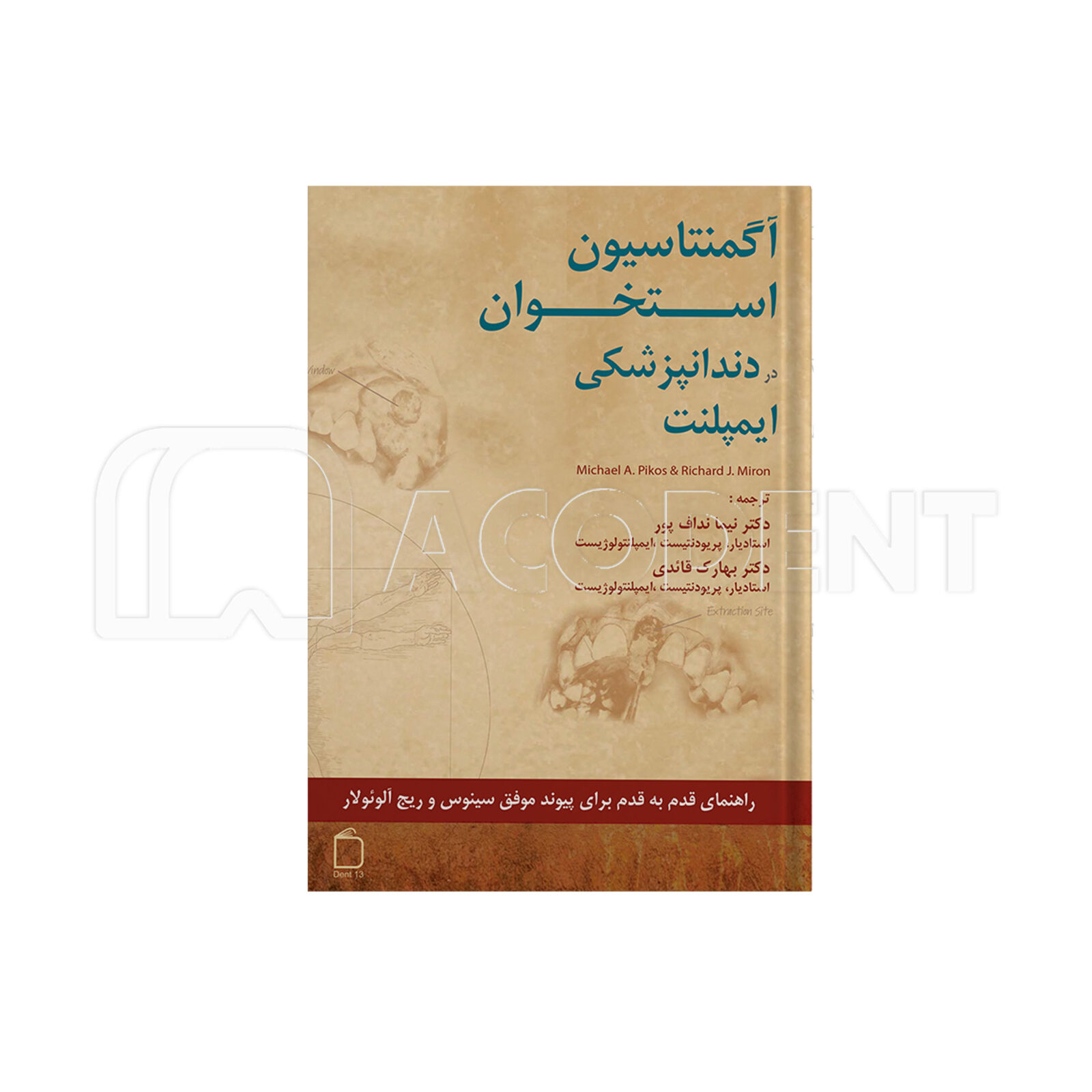 آگمنتاسیون استخوان در دندانپزشکی ایمپلنت