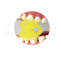 دهان بازکن لقمه ایی قابل اتوکلاو Zt Dental 1
