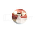 ماتریکس بند به همراه نوار تافل مایر Zt Dental 1