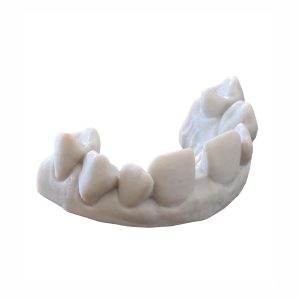آرک تمرینی ونیر دیاستم و کراودینگ فک بالا